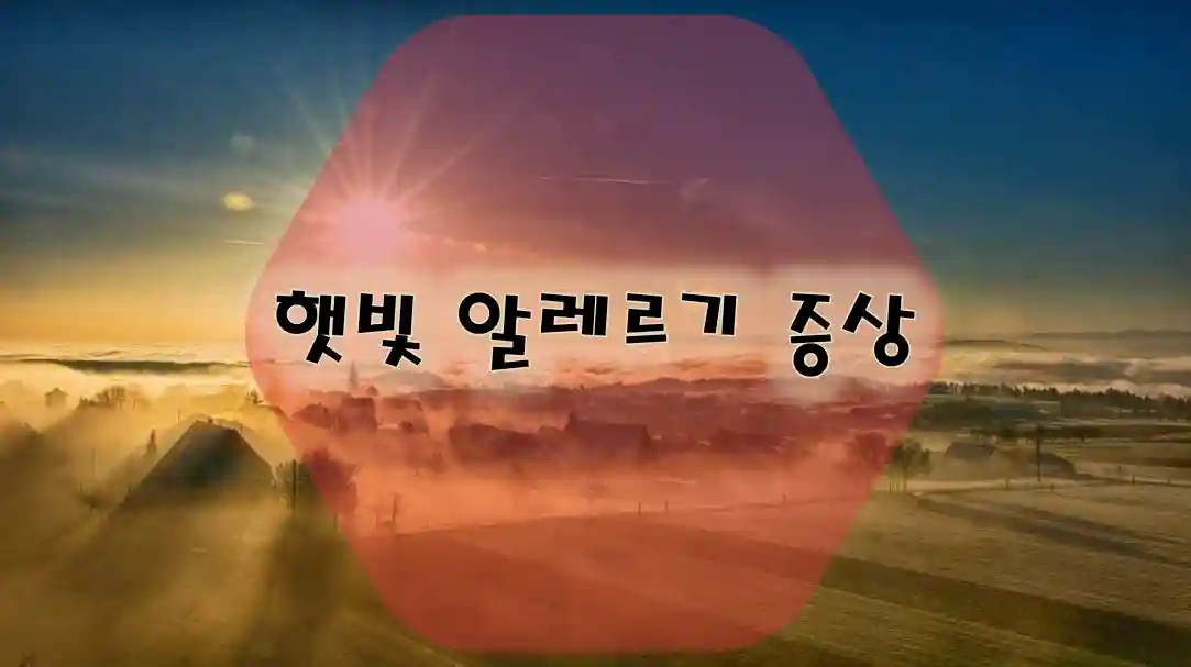 햇빛 알레르기 증상