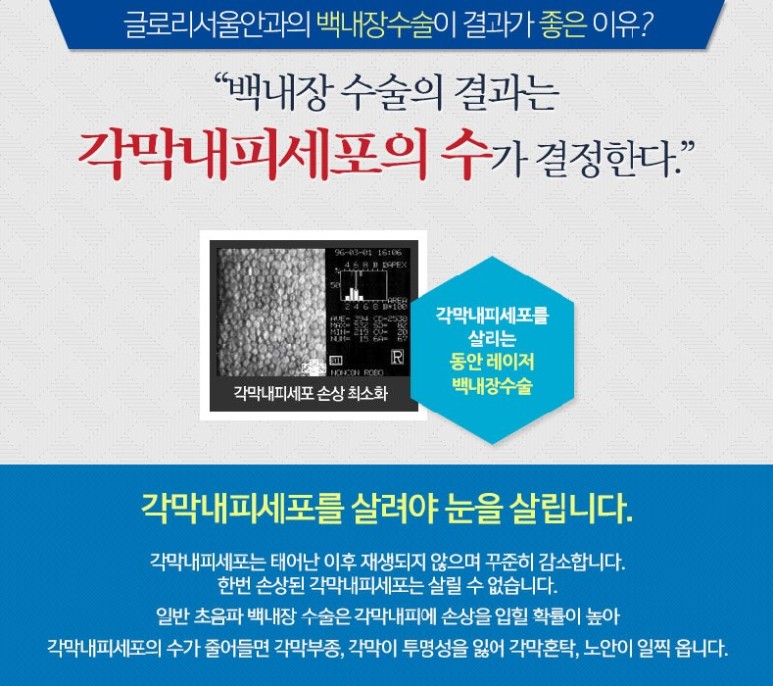 백내장 검진, 특전으로 받기 위해서는 안저 검사 등