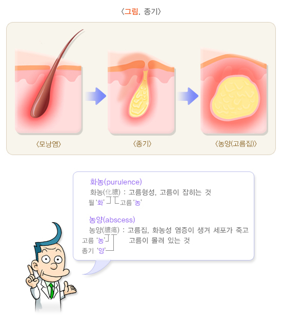  종기