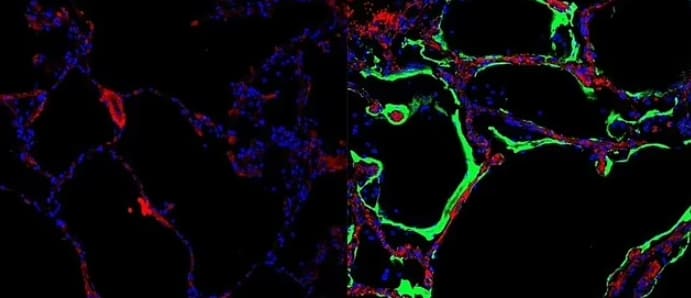  코로나와 싸우는 '폐 단백질' 발견 Australian scientists make a 'crazy interesting' Covid-19 discovery that could finally explain..