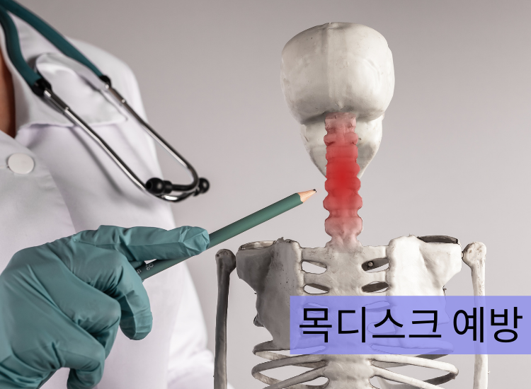 목디스크 예방