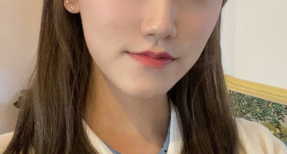 2차 코 봉오리 축소 코 조각 주사 후기교대역피부과 1개월 반 지났어 9