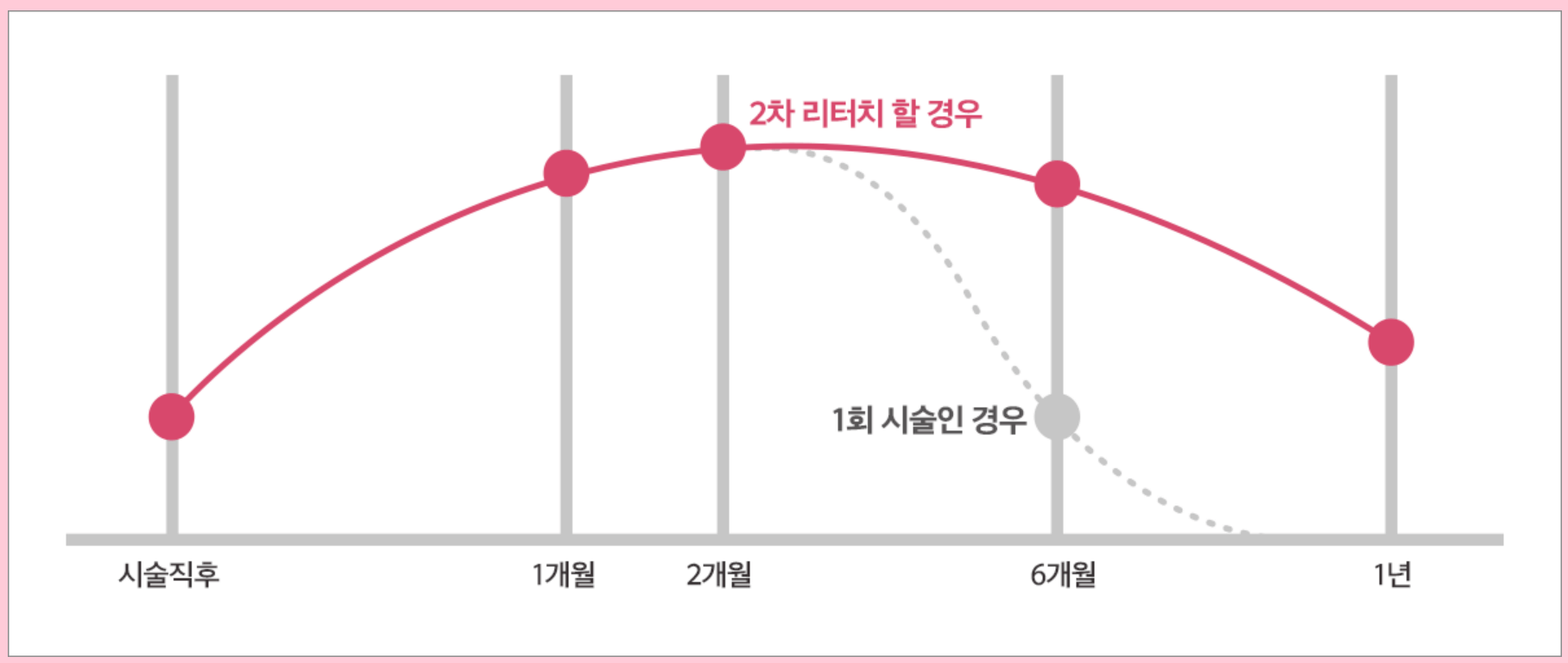 보톡스 효과 기간 가격 보톡스 부작용 후기