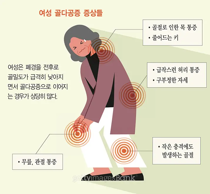  여성을 위한 튼튼한 뼈 건강, 골밀도 유지 및 강화 식품 완벽 가이드!