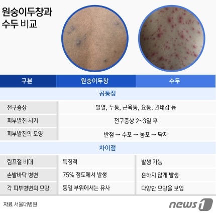 원숭이두창