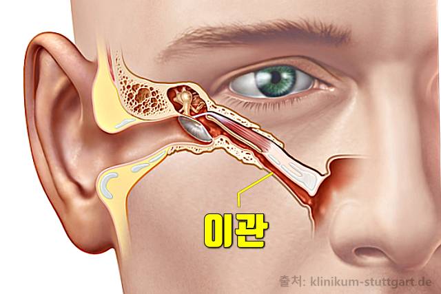 귀에서 삐소리 이명 증상 원인 이관염 중이염