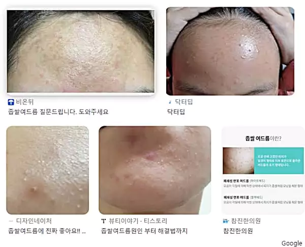 경기도 광명시 일요일 피부과 진료 추천