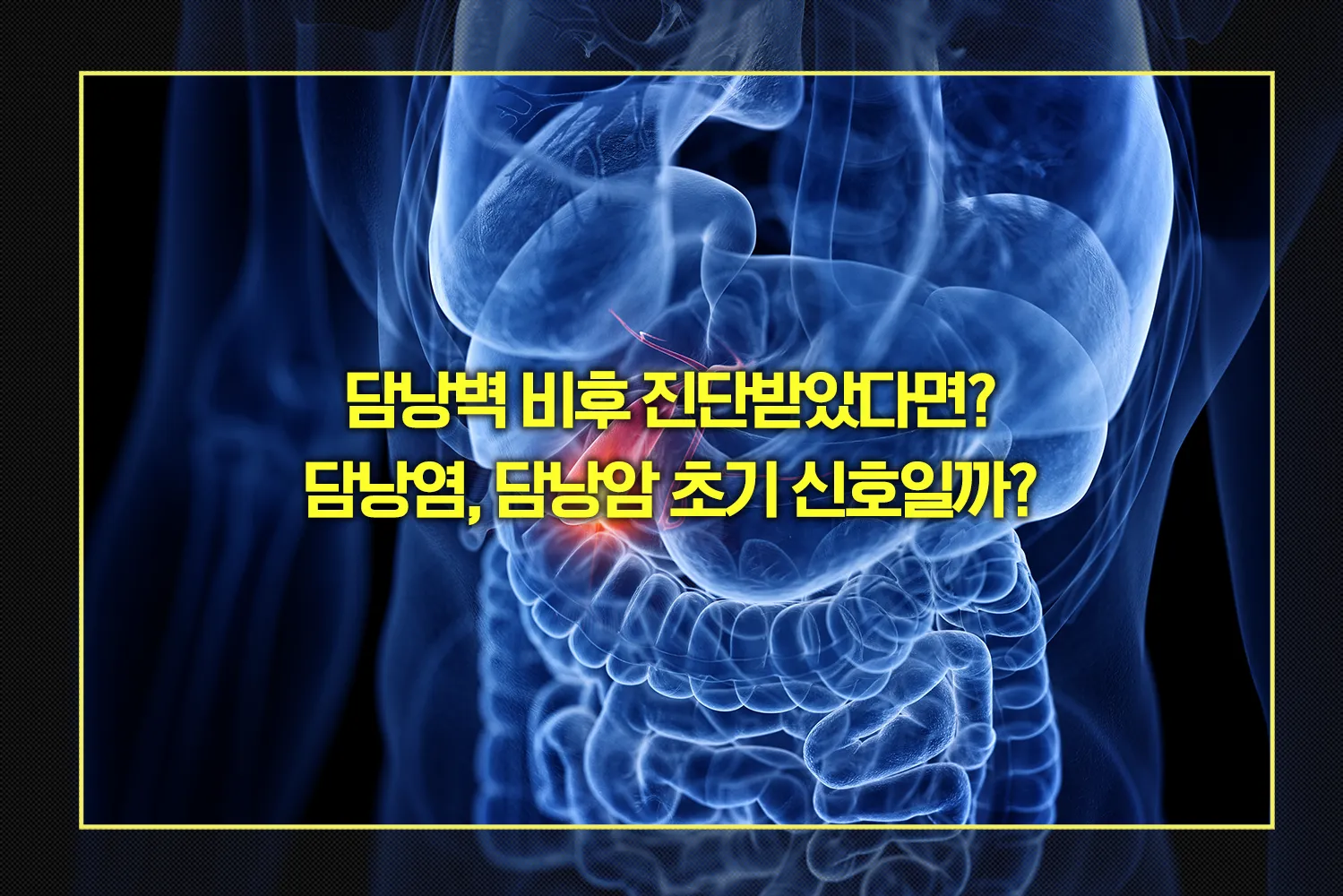 담낭벽 비후 진단