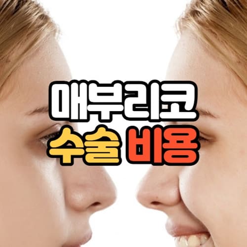 매부리코 수술비용