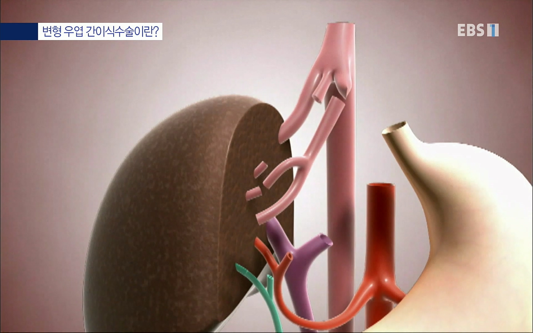EBS 명의 헬스케어 - TV - 교육의 중심 EBS명의 15년 - 간, 완치에 도전하다.mp4_20220802_202417.995.jpg