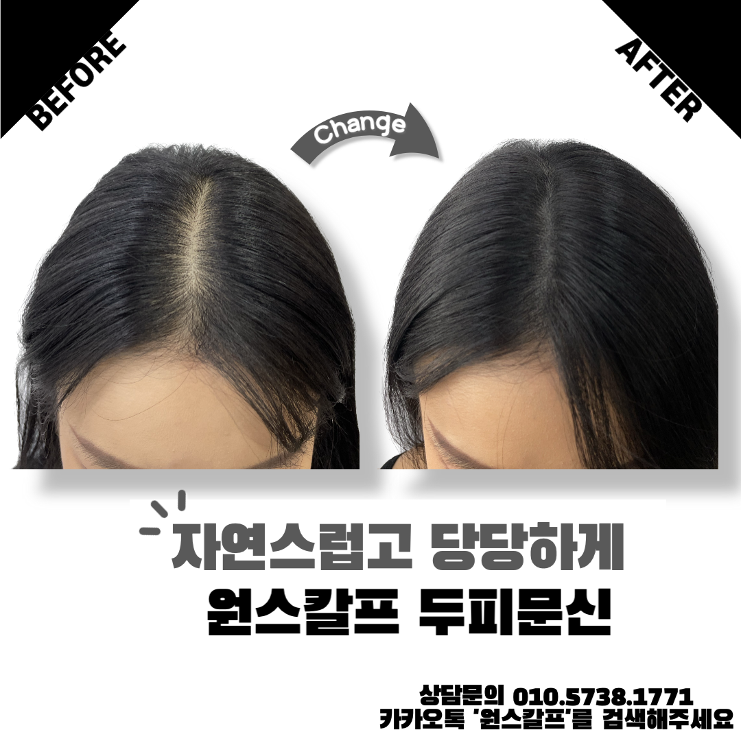  부산 서면 두피문신 모든부위 최고의 작업을 하는곳.