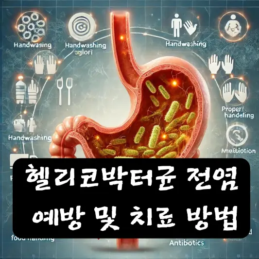 헬리코박터균 전염 예방 및 치료 방법 알아보기