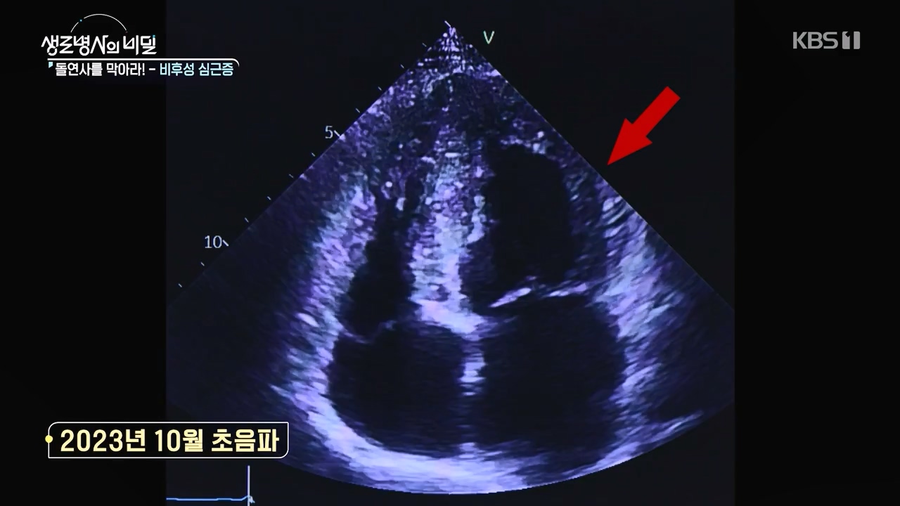 생로병사의 비밀.E912.240523p-NEXT.mp4_20240523_201958.625.jpg