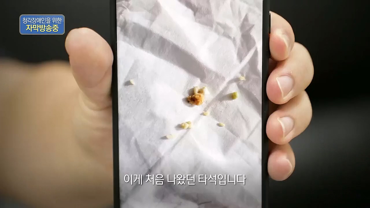 생로병사의 비밀.E851.230112p.H264-F1RST.mp4_20230119_200619.944.jpg