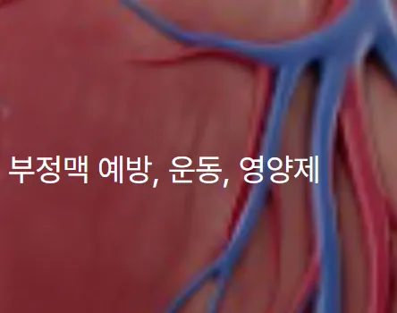 부정맥