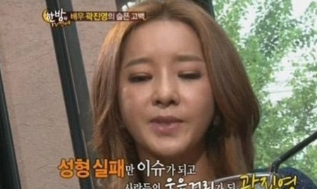  곽진영 성형수술 이유와 부작용. 자살 생각