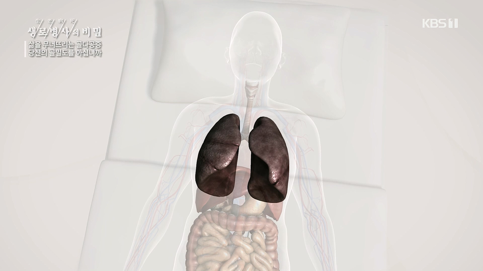 생로병사의 비밀.E852.230118p.H264-F1RST.mp4_20230120_200301.954.jpg