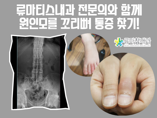 꼬리뼈 통증 병원 오랫동안 서 있거나 앉아 있는 것이 힘들어요! 2