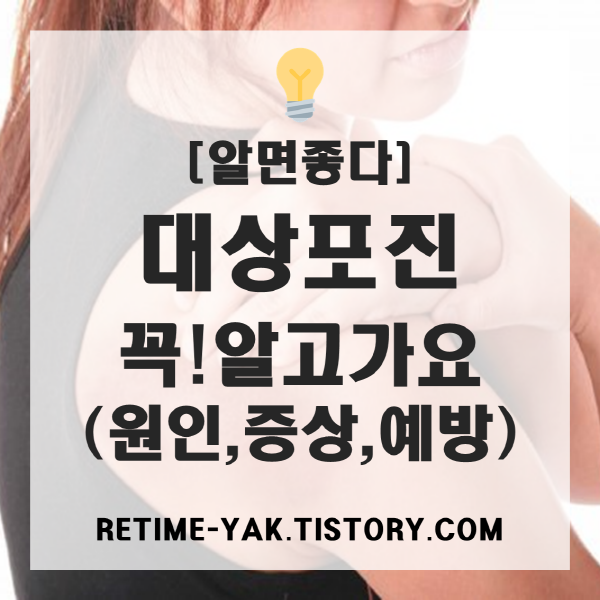  [알면좋다] 대상포진 꼭! 알고가요(원인, 초기증상, 예방, 궁금증)