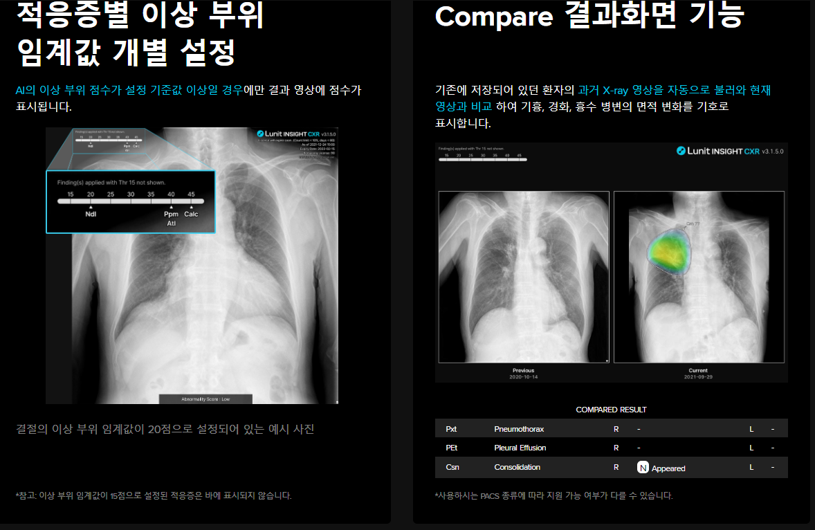 루닛 기술력