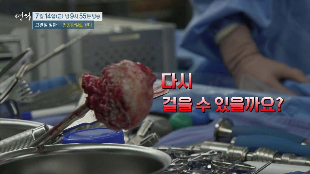 EBS 826회 명의 고관절 질환 - 인공관절로 걷다, 수술 후 합병증, 부작용 및 생활 관리, 퇴행성 관절염, 골절, 대퇴골두무혈성 괴사 치료 방법 강북 삼성병원 박윤수 박재형 교수