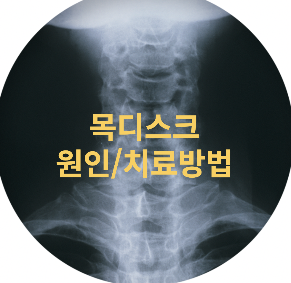  [건강정보] 목디스크 증상과 치료방법 살펴봐요