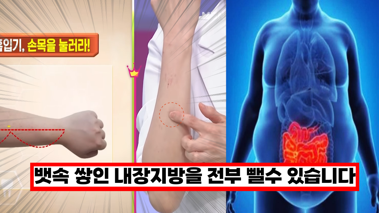  뱃속 쌓인 내장지방을 전부 뺄수 있습니다. 지방을 쫙 빠지는 이것 공개