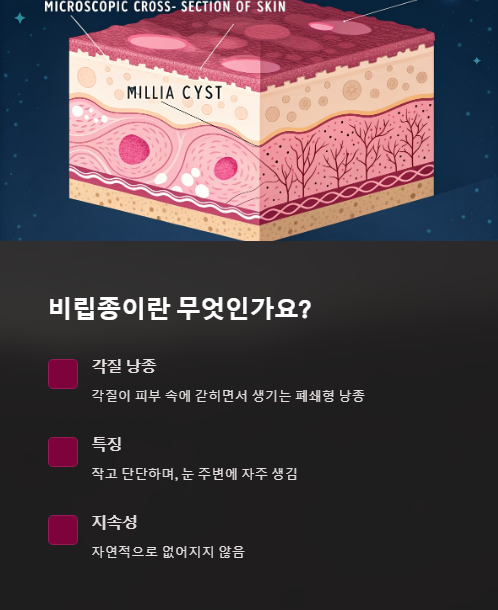 비립종이란 무엇인가요?