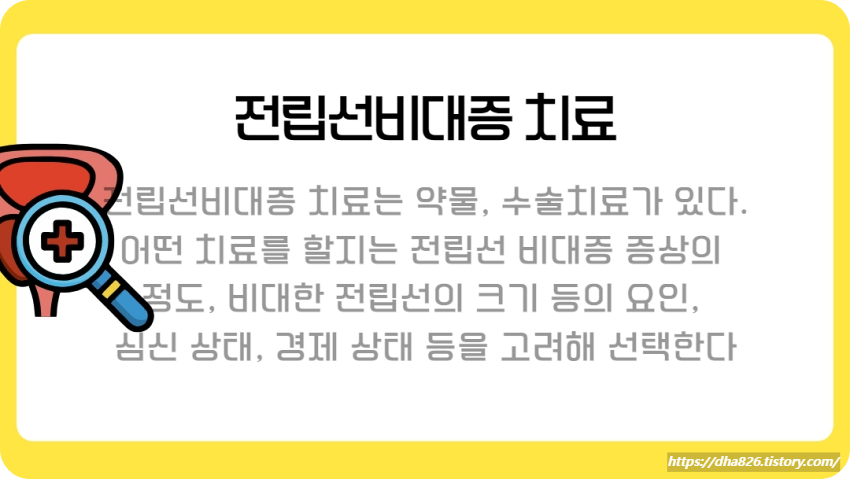 전립선비대증 치료
