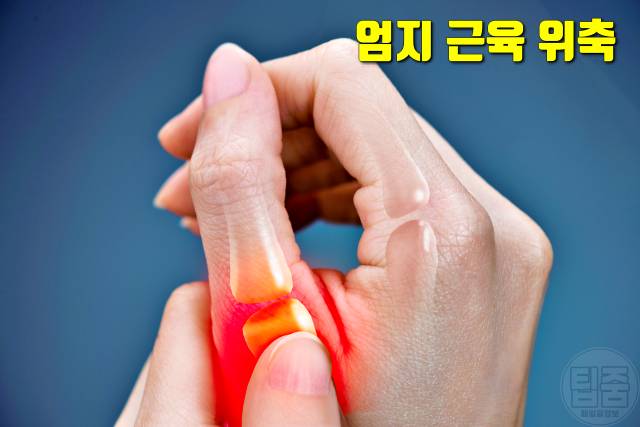 손가락 손바닥 찌릿찌릿 저림,손목터널증후군 증상
