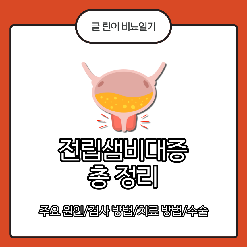  전립샘비대증 총 정리 : 주요 원인/검사 방법/치료 방법/수술