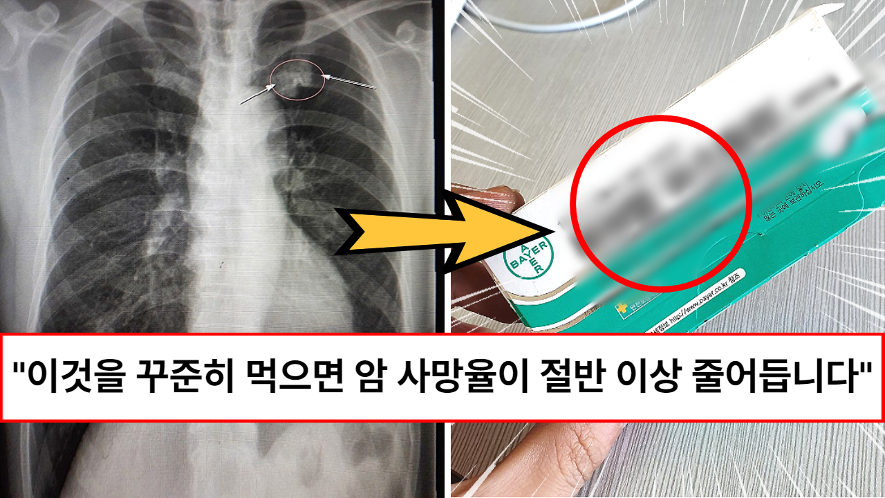 “의사들도 매일 먹습니다” 하루에 한 알씩만 먹어도 각종 암으로 인한 사망율을 현저히 낮춰준다는 이 약 “의사들도 매일 먹습니다” 하루에 한 알씩만 먹어도 각종 암으로 인한 사망율을 현저히 낮춰준다는 이 약