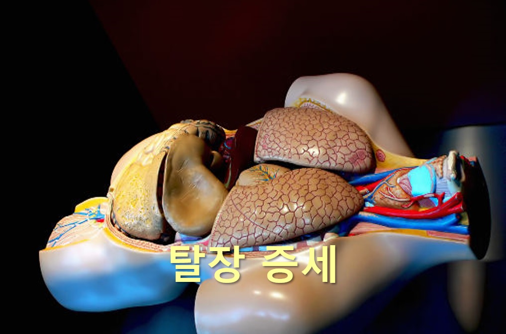  탈장 증세와 탈장 수술 방법