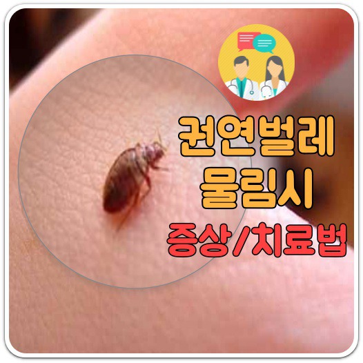 권연벌레 물림 증상에 따른 치료법 권연벌레 물림 증상에 따른 치료법