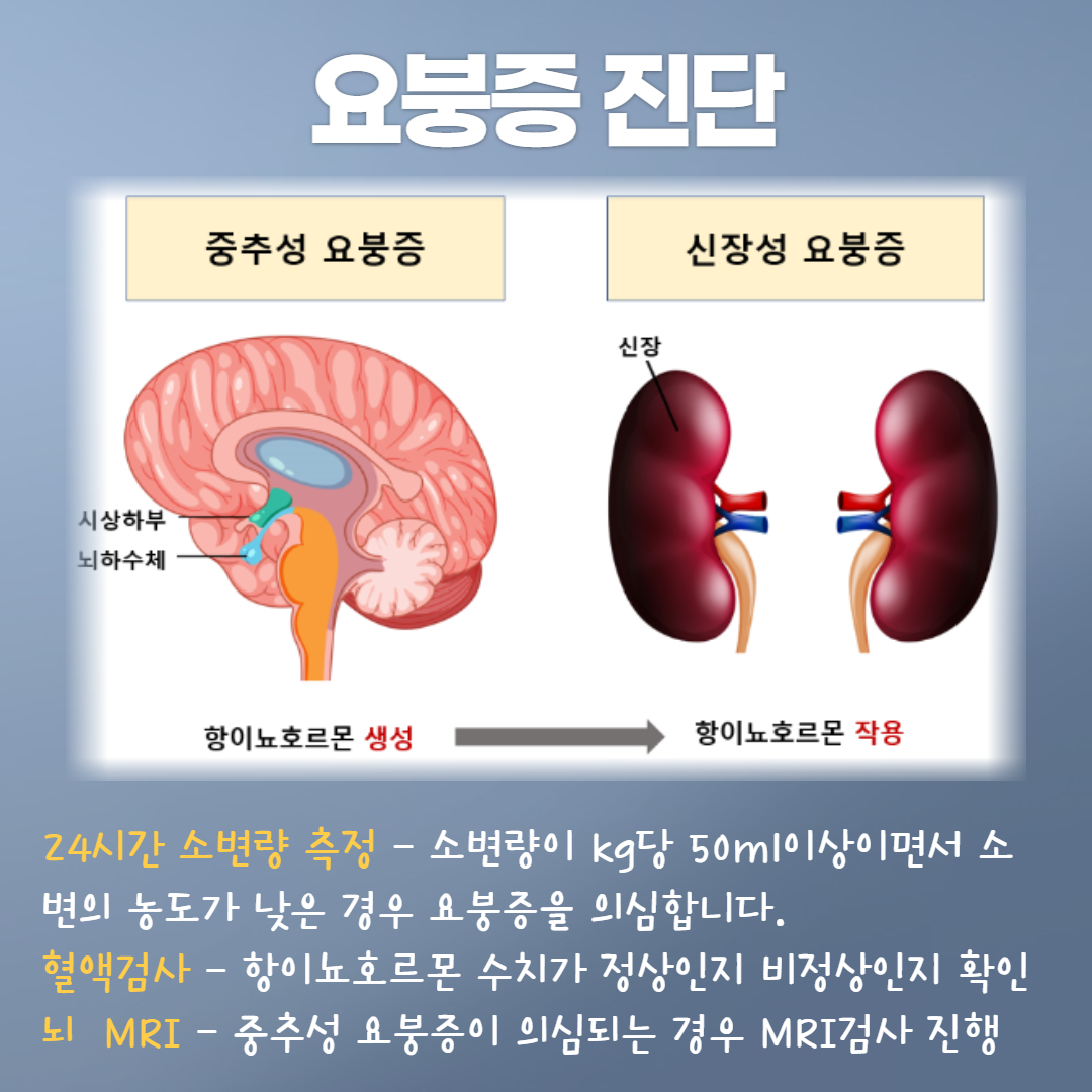 요붕증 진단