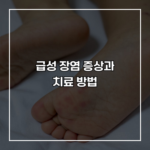 아이들에게 흔한 수족구병, 어떻게 대처할까?