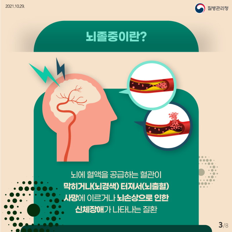 뇌졸중