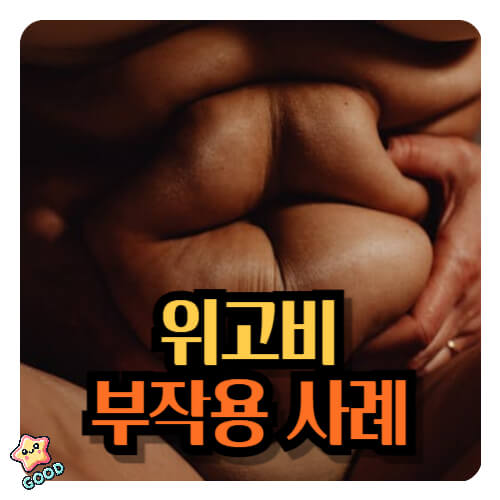 위고비-부작용-사례