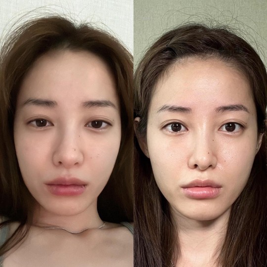  유깻잎, 성형 후 자신감! Before & After 당당히 공개! [사진]