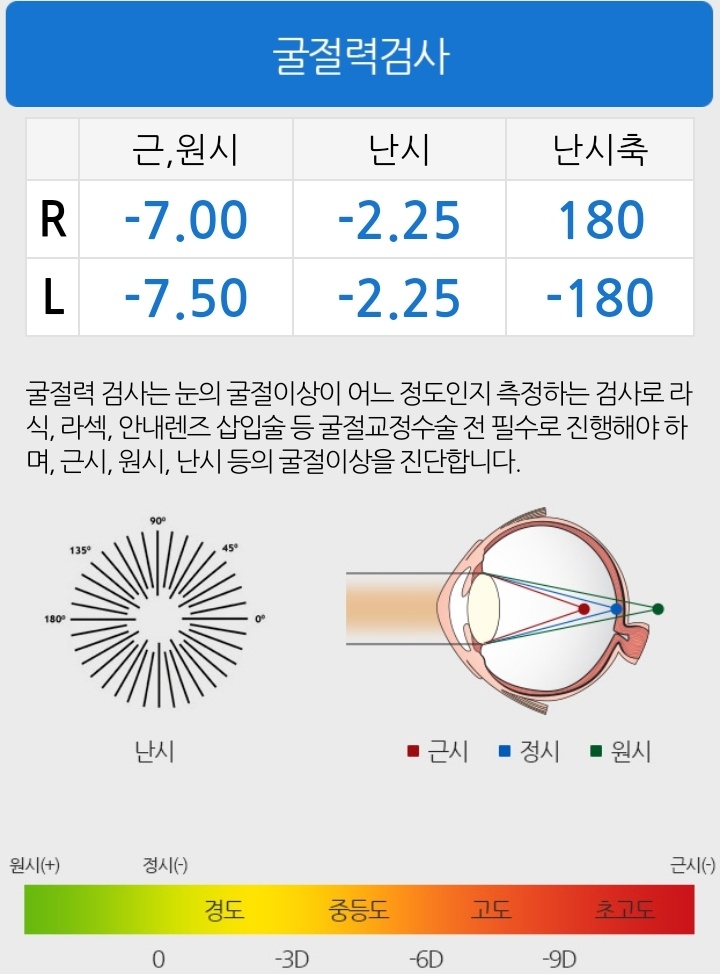 강남 밝은성모안과⟫ 라섹 당일 수술 후기 강남 밝은성모안과⟫ 라섹 당일 수술 후기
