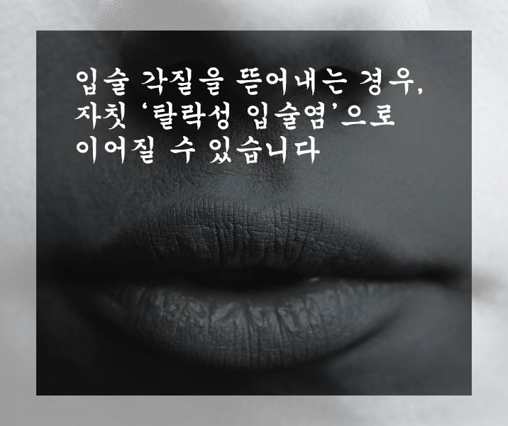  입술 각질을 뜯어내는 경우, 자칫 ‘탈락성 입술염’으로 이어질 수 있습니다