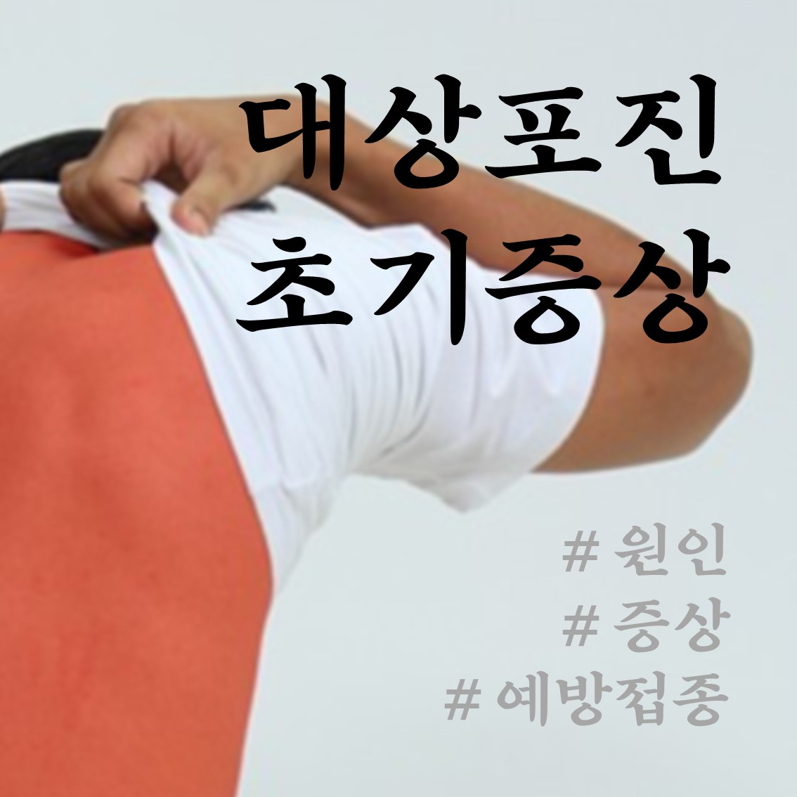  대상포진 초기증상 및 예방접종 가격 알아보기