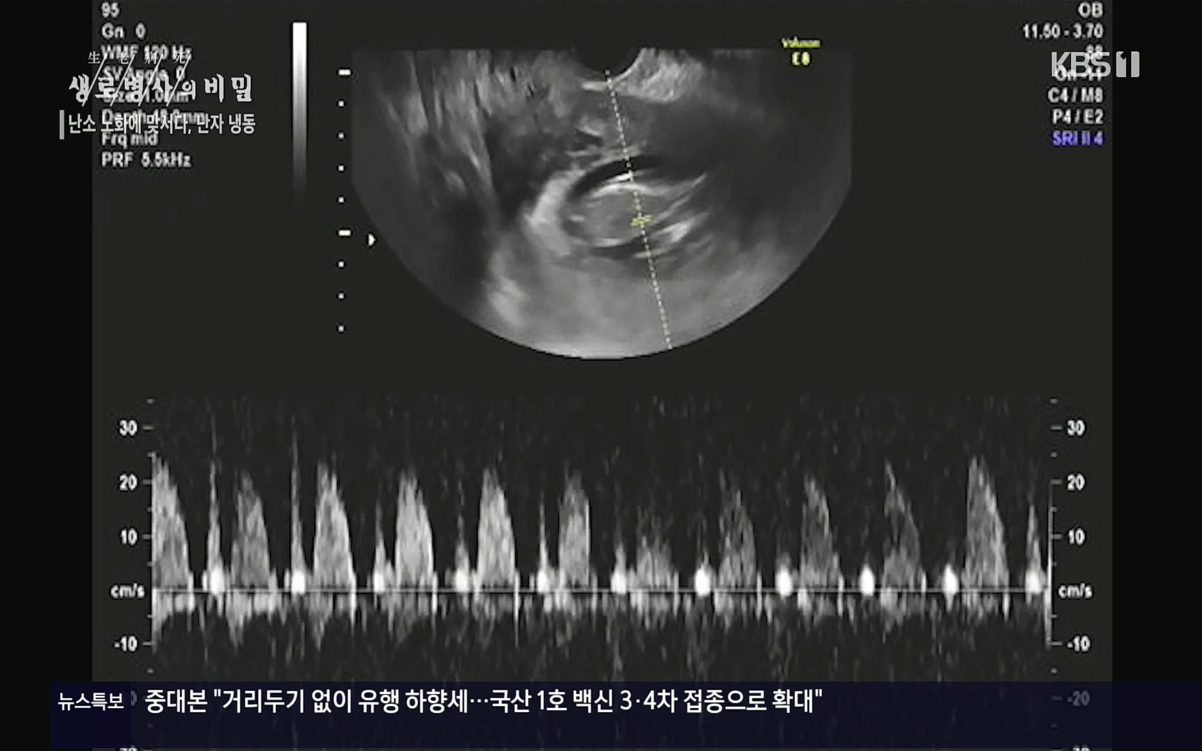 생로병사의 비밀.E836.220921p.H264-F1RST.mp4_20220925_183655.633.jpg