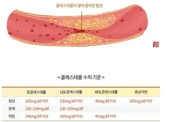 총콜레스테롤 이란 정상수치 낮추는법_3