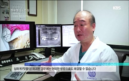 [670회] 생로병사의 비밀 - KBS670회] 생로병사의 비밀.ts_20220505_143212.841.jpg