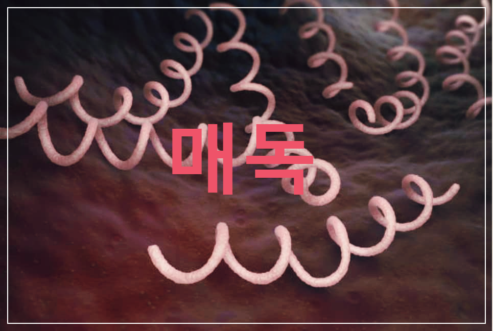  매독 : 전염력이 매우 강하고 위험한 성병