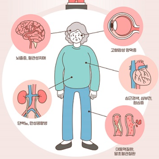고혈압 증상 10가지 총정리 섬네일