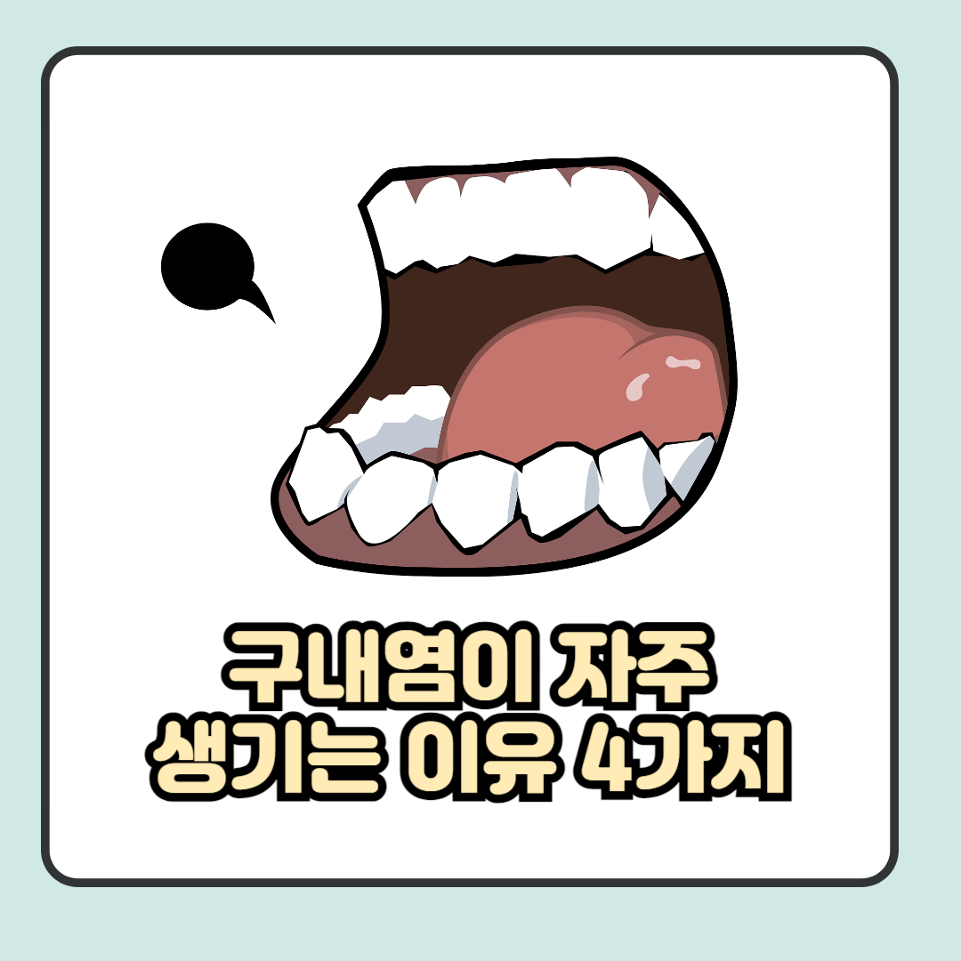 구내염이 자주 생기는 이유 4가지