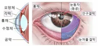 눈이 침침하고 피곤한 증상