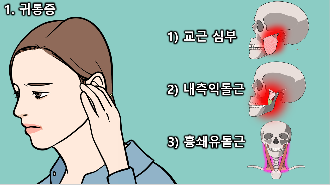 턱관절 근육통 통증유발점과 이비인후과 증상 총정리